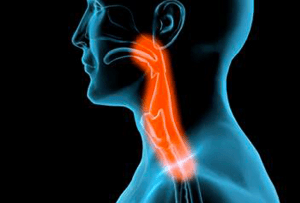 Head and Neck Cancer